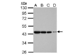 Rabbit Polyclonal beta Actin   Antibody